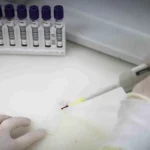 Meningite é confirmada em paciente investigado por suspeita de ebola em SP