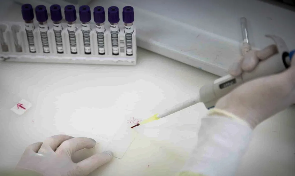 Meningite é confirmada em paciente investigado por suspeita de ebola em SP
