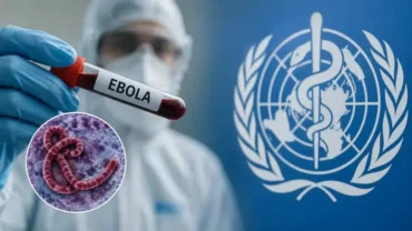EBOLA