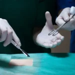 Justiça de Mato Grosso encerra espera de 8 meses e determina cirurgia urgente para criança com doença renal