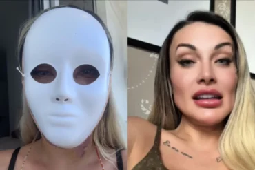 Andressa Urach passa por nova cirurgia plástica e fala em reencontro pessoal