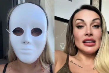 Andressa Urach passa por nova cirurgia plástica e fala em reencontro pessoal