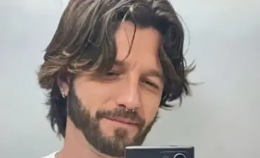 Diogo Venturieri relata susto com piercing após acidente inesperado