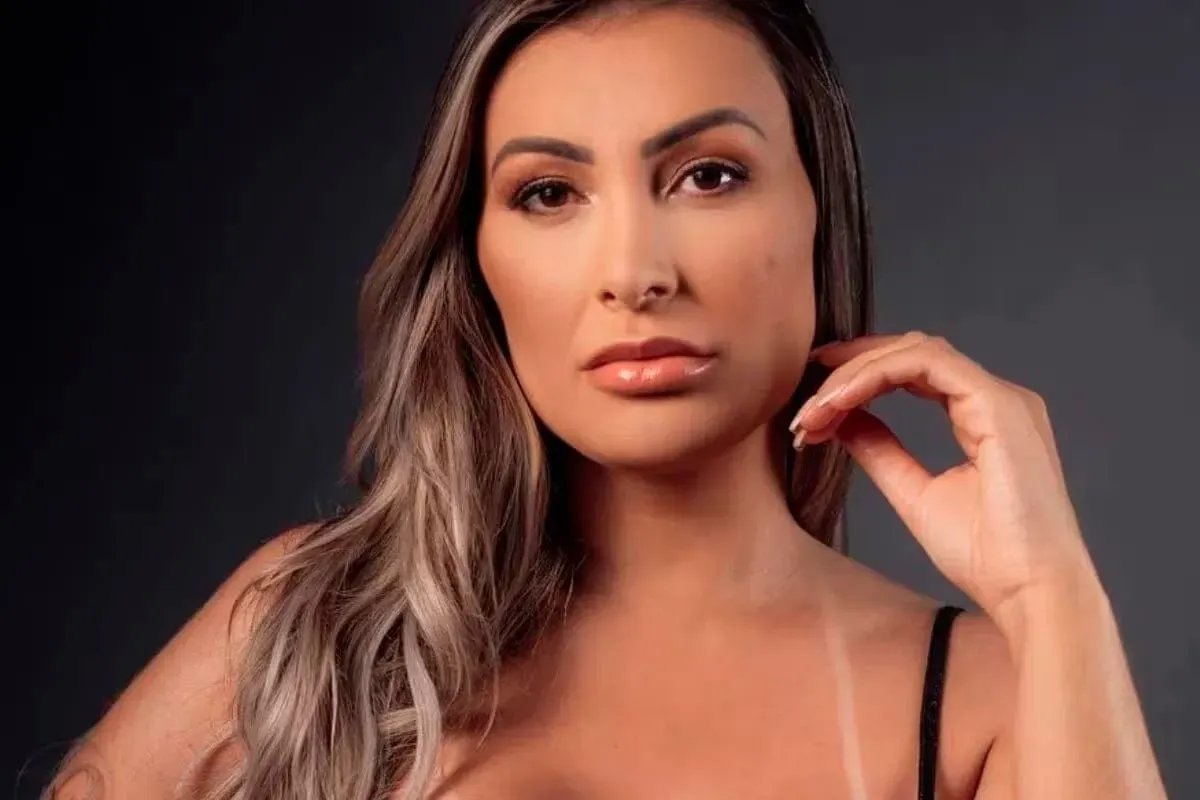 Andressa Urach exibe novo rosto após lifting facial e transformação estética