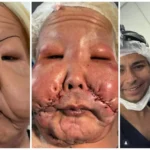 Juju do Pix mostra resultado da reconstrução facial após seis meses