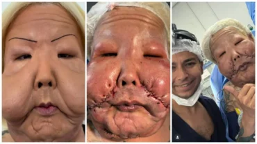 Juju do Pix mostra resultado da reconstrução facial após seis meses