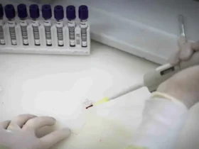 Ebola: Secretaria de Saúde de SP investiga novo caso suspeito em brasileira que veio do Congo