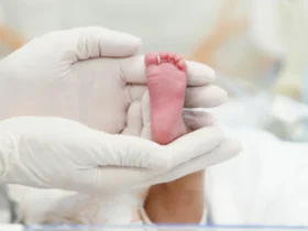 Ainda segundo o boletim, os pais levantaram a hipótese de que o estado de saúde do bebê poderia ter relação com vacinas aplicadas anteriormente.
