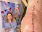 Vera Fischer revela cirurgia no joelho e explica decisão: ‘Preferi viver’