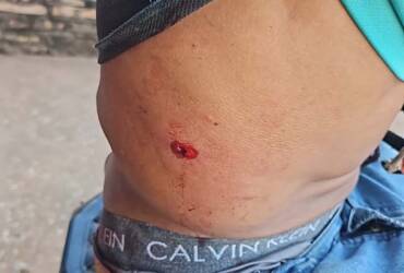 Homem é alvejado a tiros em via pública em Cáceres em plena luz do dia