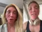 Peeling: Maya Massafera explica inchaço no rosto