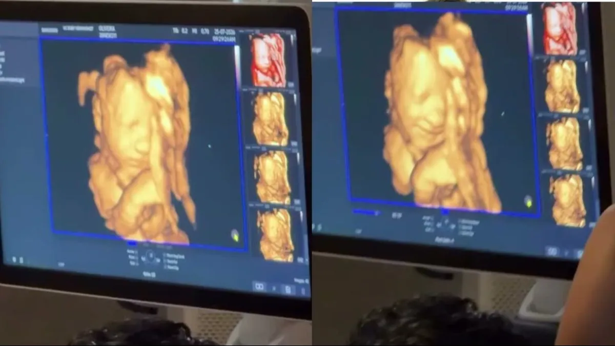 Ultrassom mostra bebê sorrindo ao ouvir o pai