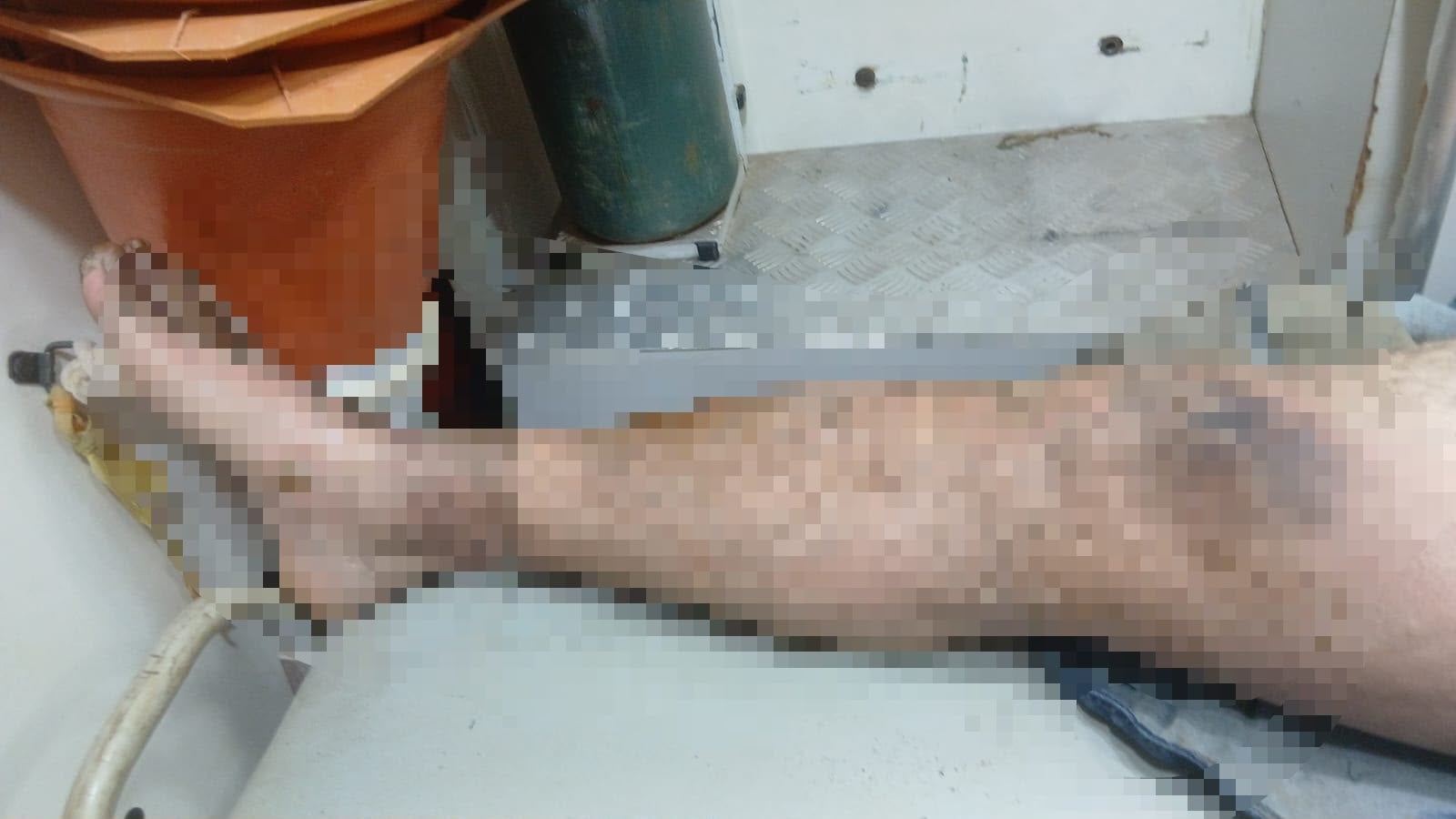 Trabalhador sofre queimaduras de 3º grau em acidente elétrico em Lucas do Rio Verde